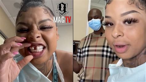 why chrisean missing a tooth|Chrisean Rock Reveals She Is Replacing Her Tooth。